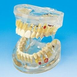 Onemocnn zub