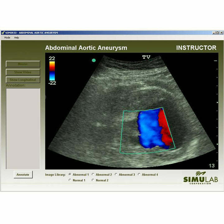 SNMA-21 - AAA modul pro diagnostick ultrazvukov trenar SonoMan